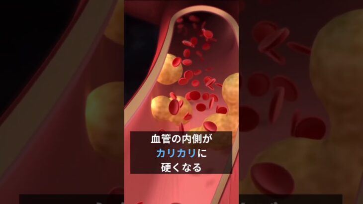 【血糖値高い 足のむくみ】#糖尿病 #糖化