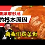 老梁揭祕系列-梁宏達講述：糖尿病形成的根本原因，在於這幾大因素，離我們這麼近！老梁的評價壹針見血