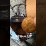 ミレービスケットは1日1袋まで 糖尿病全食事記録989日目