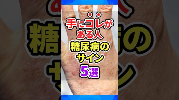 手に出る“糖尿病のサイン”5つ 見逃すと危険です