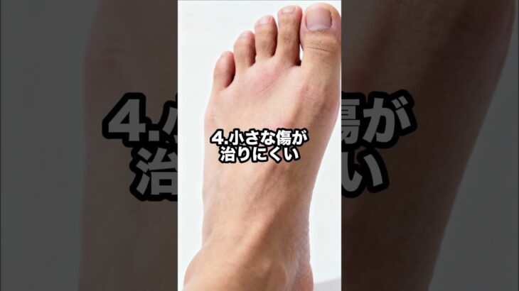 【足で分かる】糖尿病の初期症状5選