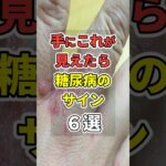 【9割が知らない】手に”コレ”が見えたら糖尿病のサイン６選！　#あなたの健康を守るライフハック　 #健康 #雑学  #医療 #糖尿病   #shorts