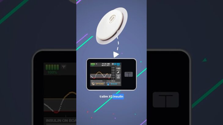 Tandem t:slim X2 Pump Now Supports the Libre 3 Plus CGM