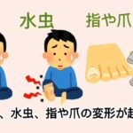 【糖尿病】フットケア