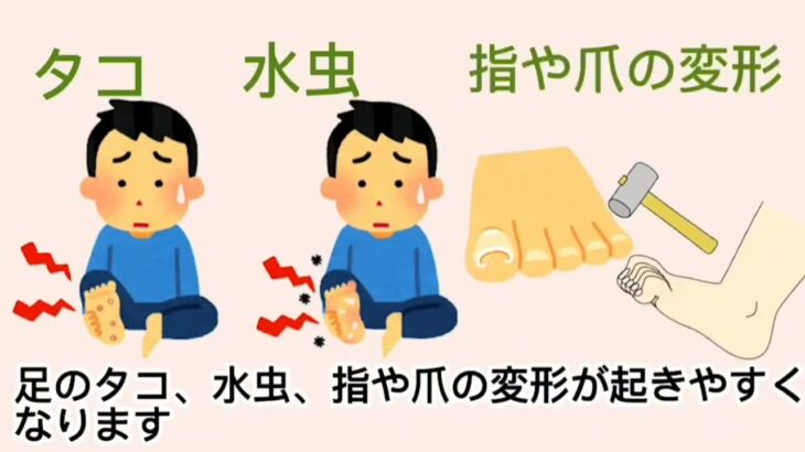 【糖尿病】フットケア