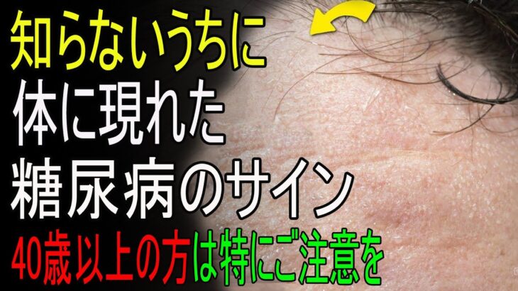 知らぬ間に始まっている糖尿病…体が送る糖尿病のサイン｜老年の知恵｜老後の秘話｜人生の記録｜オーディオブック｜究極の知恵
