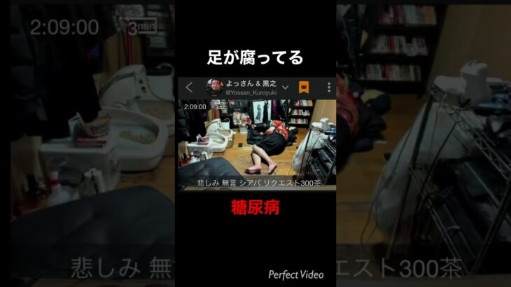 よっさんの腐った足の裏 #糖尿病