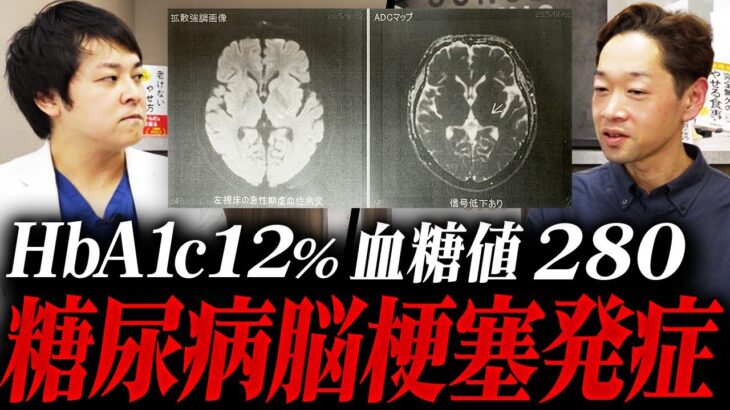 【糖尿病通院の自己中断】大変なことになりました【現役糖尿病内科医】