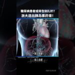 糖尿病患者或将告别扎针？浙大造出胰岛素药膏！