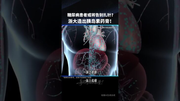 糖尿病患者或将告别扎针？浙大造出胰岛素药膏！