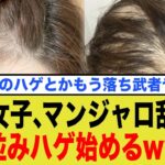 糖尿病治療薬『マンジャロ』、使用者たちが次々とハゲ始める衝撃の副作用がヤバすぎる…