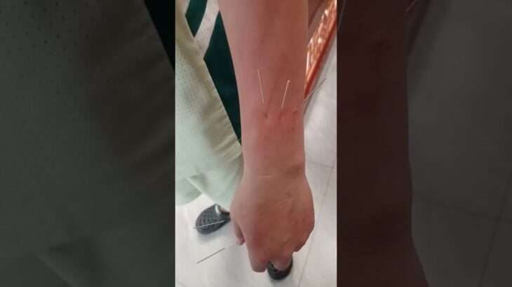 有想调理糖尿病的，我我