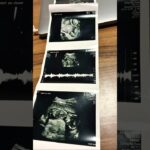 産婦人科でした！高血圧も糖尿病もなく赤ちゃんも順調で問題無しです！大事なところ隠れてたので性別はまた次回です💦眠そうでバンザイして顔の上に腕乗せてる赤ちゃんでした👶#妊娠中 #15週 #妊娠初期