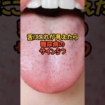 舌にこれが見えたら糖尿病のサイン5つ　　　　　　　　　　#健康 #健康雑学  #糖尿病 #健康生活VOICEVOX: 青山龍星
