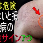 絶対に見逃さないで！知らないと後悔する糖尿病の危険な7つの症状とは？