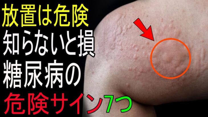 絶対に見逃さないで！知らないと後悔する糖尿病の危険な7つの症状とは？