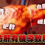 飲酒 血壓高 糖尿病 肥胖 脂肪肝有機導致肝癌｜ 健康關注組 ｜ EP476 ｜ 脂肪肝 ｜ 肝癌 ｜ 黃芳雯 ｜ 麥詩敏 ｜ HOY TV