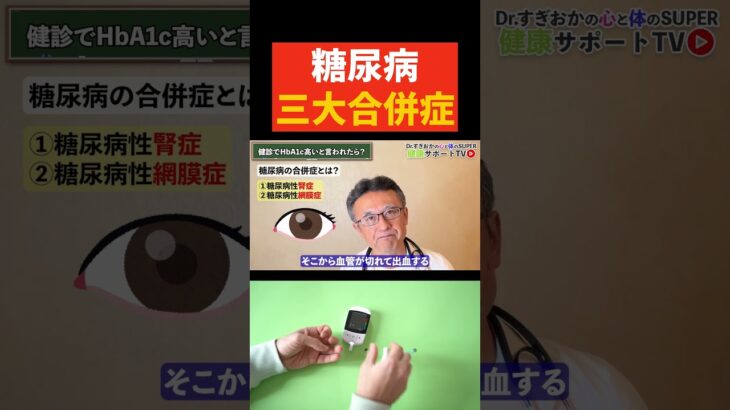 【糖尿病】健康診断でHbA1cが高かった人へ三代合併症について循環器内科医が解説　#すぎおかクリニック