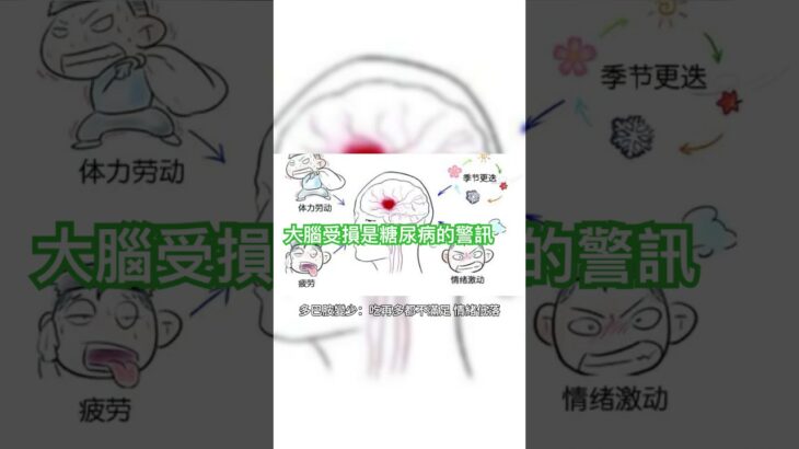 糖尿病，其實是「大腦先出問題」#糖尿病 #大腦健康 #血糖控制 #健康生活 #代謝平衡 #Mandy健康筆記 #Diabetes #BrainHealth #Metabolism