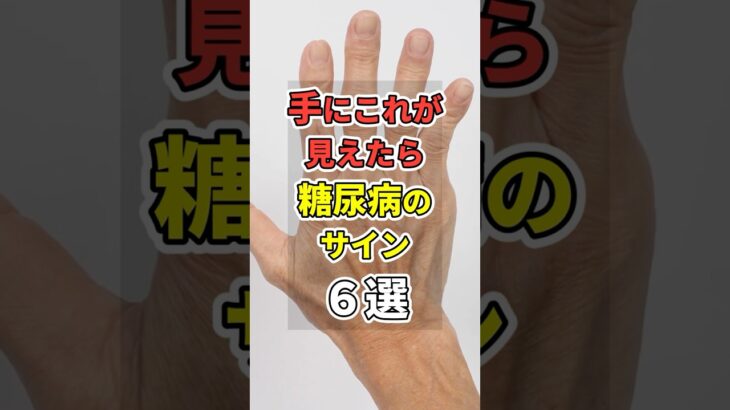 【最悪】手に”コレ”が見えたらの糖尿病のサイン６選！　#あなたの健康を守るライフハック　 #健康 #雑学  #医療 #糖尿病    #shorts