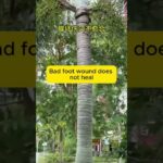 为什么很多糖尿病，不是病死，是拖死。 #uncle dockong #独刚 #夜尿