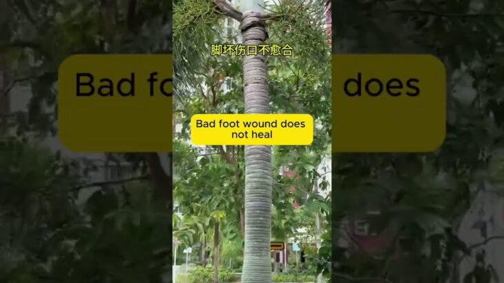 为什么很多糖尿病，不是病死，是拖死。 #uncle dockong #独刚 #夜尿