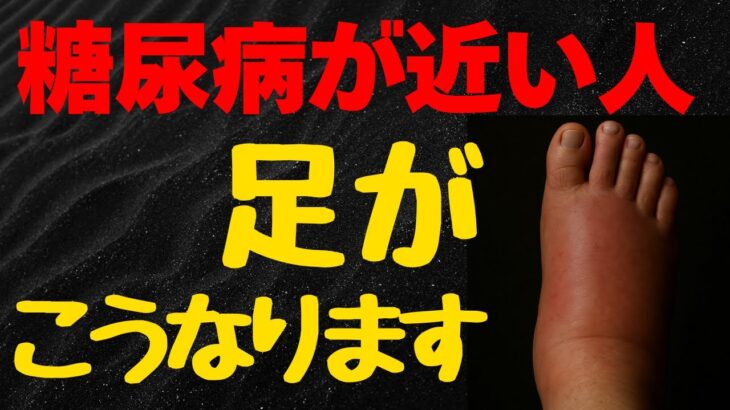 糖尿病が近い人だけに起こる「足の危険信号」見逃すと足を切断することになります！