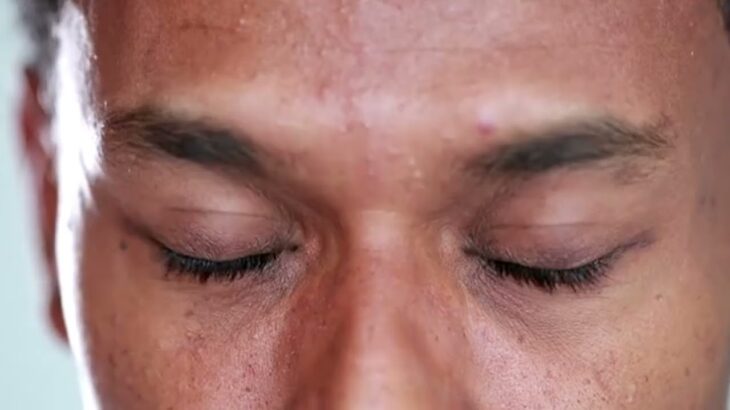 糖尿病視網膜病變 病因、症狀與治療