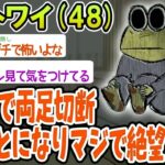 【悲報】糖尿病で両足切断することになりマジで絶望してる。