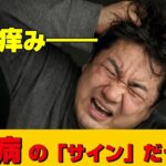 股の痒み――糖尿病の“サイン”だった（糖尿病とカンジダ症）