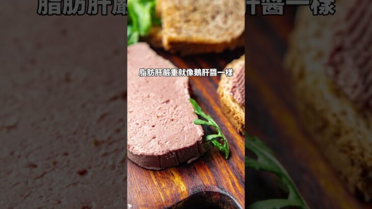 糖尿病不是吃太甜，而是吃進太多熱量！