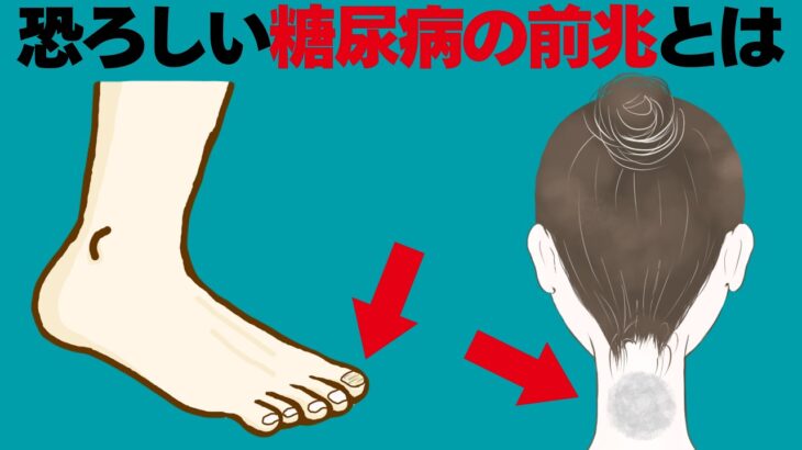 恐ろしい糖尿病の初期症状！絶対に見逃してはいけない糖尿病の前兆、体にあらわれるサインとは？【誰かに話したくなる健康雑学】