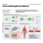 049-糖尿病干细胞疗法