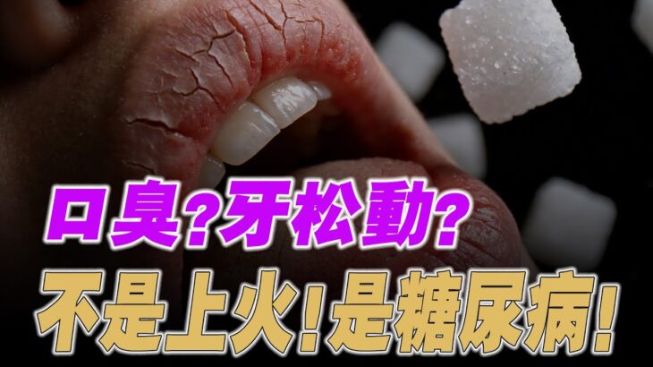 糖尿病症狀  這 10 個身體求救訊號，可能是糖尿病前兆 ~ 口腔 牙 皮膚 酵母菌(別等洗腎才後悔)【納福小站】#喵一下 #養生