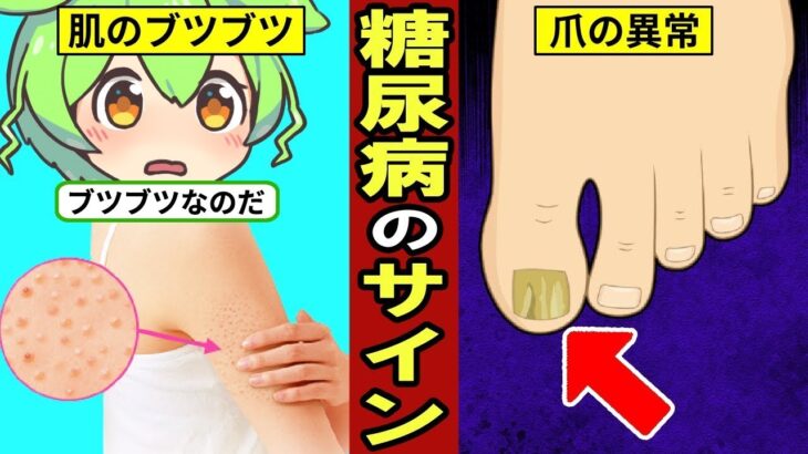 恐ろしい糖尿病！見逃せない危険なサイン10選をご紹介します【ずんだもん｜高血糖｜食事｜ヘモグロビンA1c】