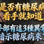 是否有糖尿病，看手就知道，手部有這3種異常，暗示糖尿病來了！#老年健康 #血糖控制 #健康科普