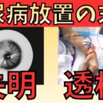 【内科医が警告】糖尿病を放置すると現れる重大なサイン6選