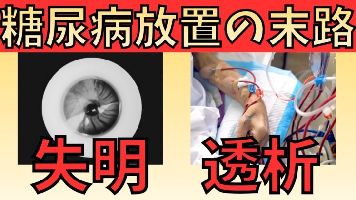 【内科医が警告】糖尿病を放置すると現れる重大なサイン6選
