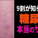 見落とすと一生後悔する糖尿病の7つのサインとHbA1Cの本当の基準【ゆっくり解説】