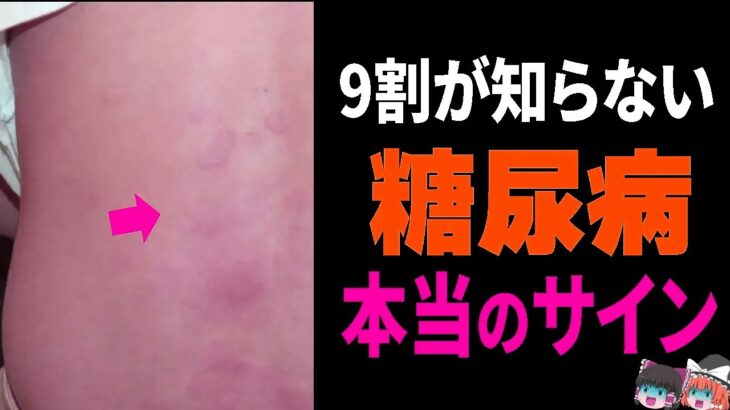 見落とすと一生後悔する糖尿病の7つのサインとHbA1Cの本当の基準【ゆっくり解説】