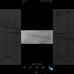 #蜂窩織炎#糖尿病#糖尿病食事#血糖値降下#hba1c降下#食後運動#FX#利益