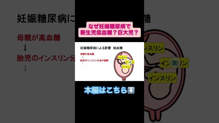 妊娠糖尿病で新生児低血糖や巨大児のリスクがある理由　#国家試験 #看護学生 #合格