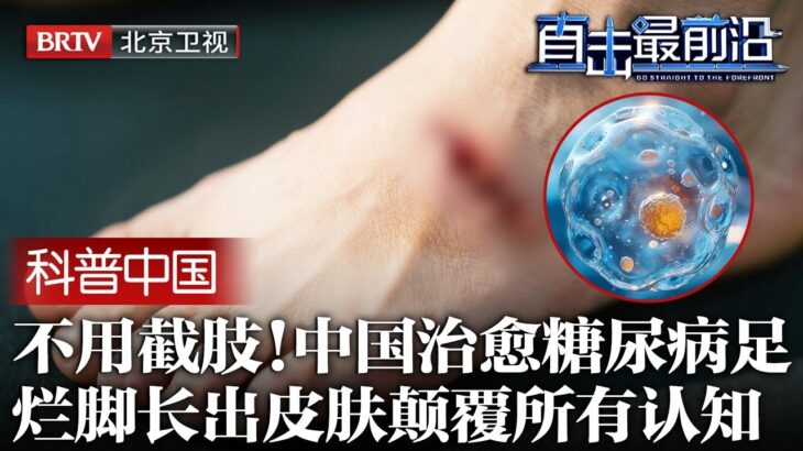 不用截肢！中国治愈糖尿病足！烂脚重新长出皮肤，中国给出方案，再生医学颠覆所有权威认知【科普中国直击最前沿】