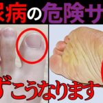 【医師監修】絶対に見逃すな！糖尿病で起こりやすい「足の危険サイン」と症状・予防法を徹底解説