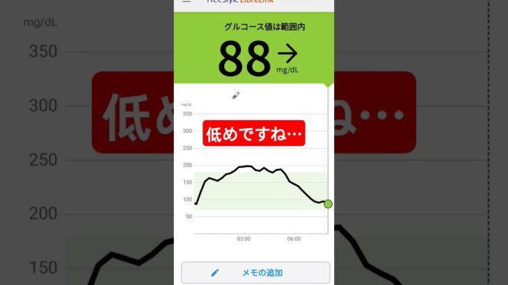 #1型糖尿病 #リブレ