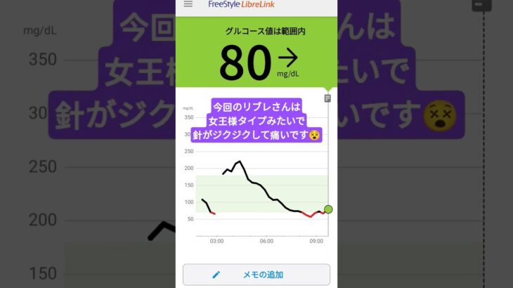 #1型糖尿病 #リブレ