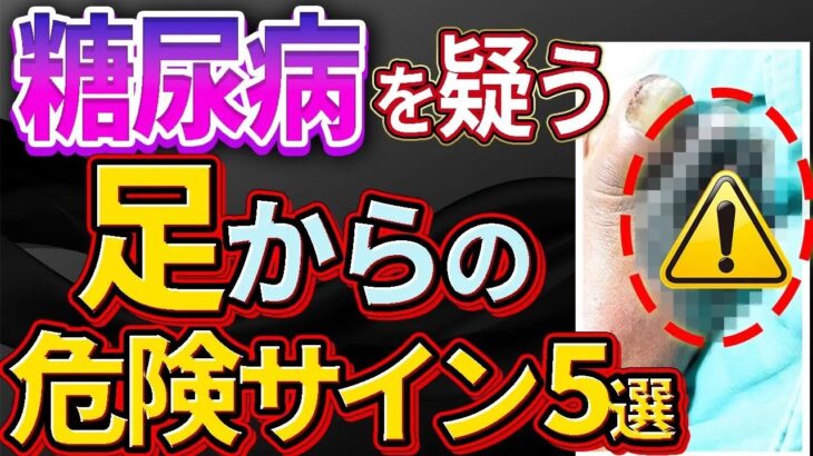 放置厳禁絶対見逃してはいけない糖尿病を疑う足の症状5選について解説します
