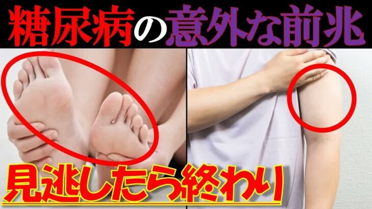 【医師監修】見逃すと危険！糖尿病の初期症状7つとは？当てはまる人は今すぐ要注意