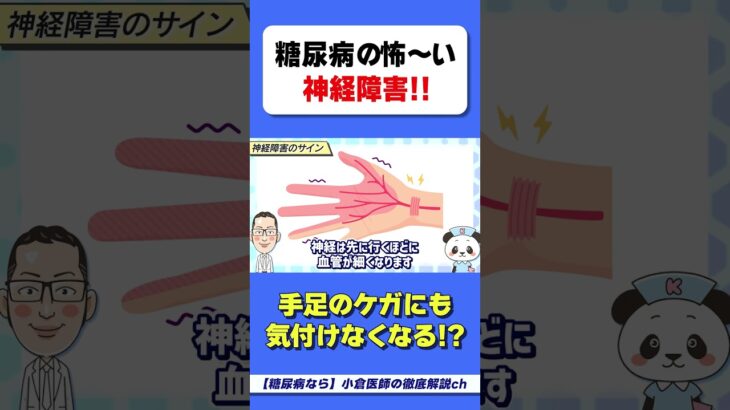 【怖い】糖尿病の神経障害　#HbA1c　#糖尿病　#手足の怪我　#気がつかない