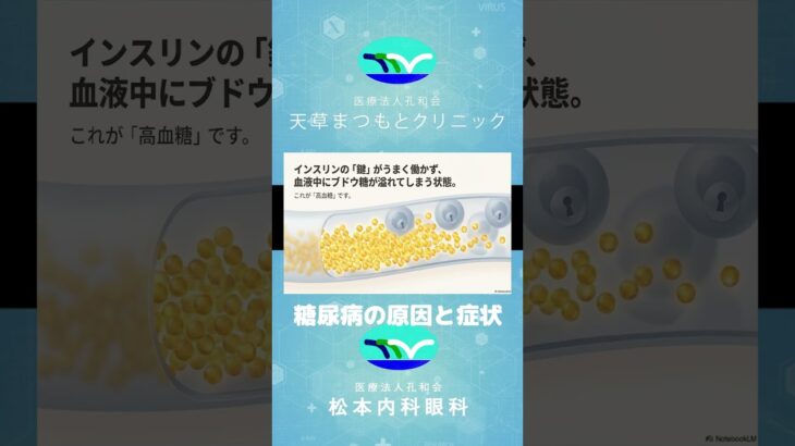「知ることで変わる！」糖尿病の原因と症状とは！？ #血糖 #hba1c #インスリン #糖尿病 #糖尿病治療 #血糖コントロール